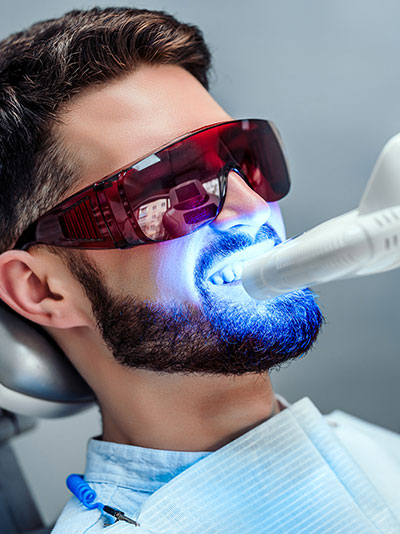root canals